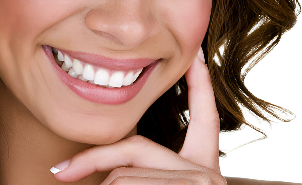 Your Guide to Teeth Whitening in Texas: Services Offered by Keller Family Dental_2